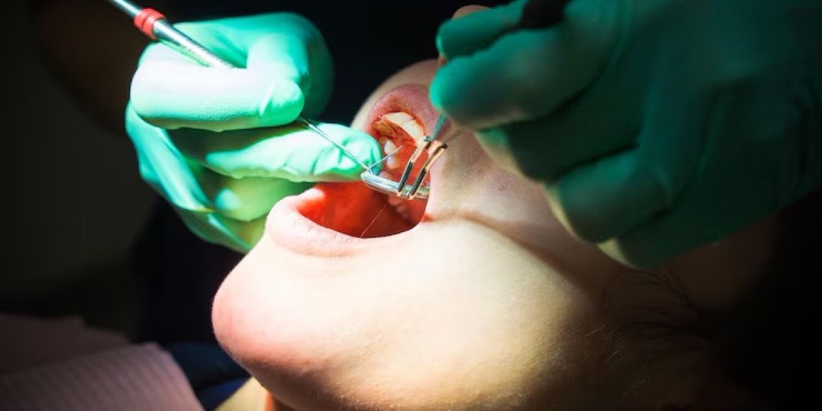 Understanding the Risks and Benefits of Wisdom Tooth Extractions