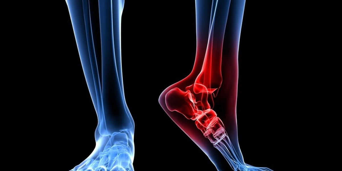 Why Do You Face Ankle Pain Without Injury?